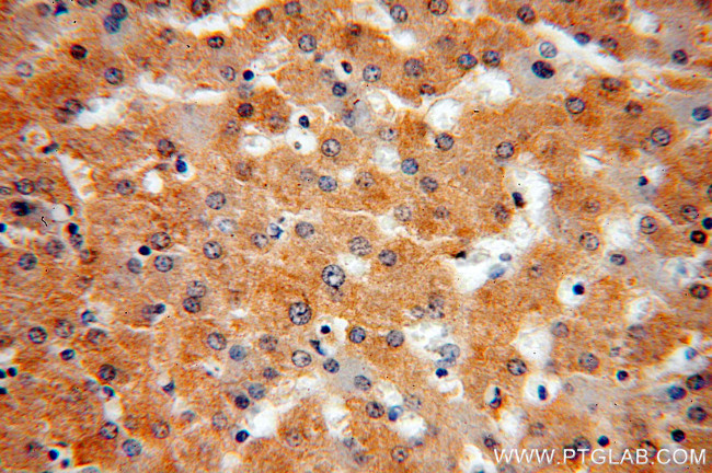 IkB alpha Antibody in Immunohistochemistry (Paraffin) (IHC (P))