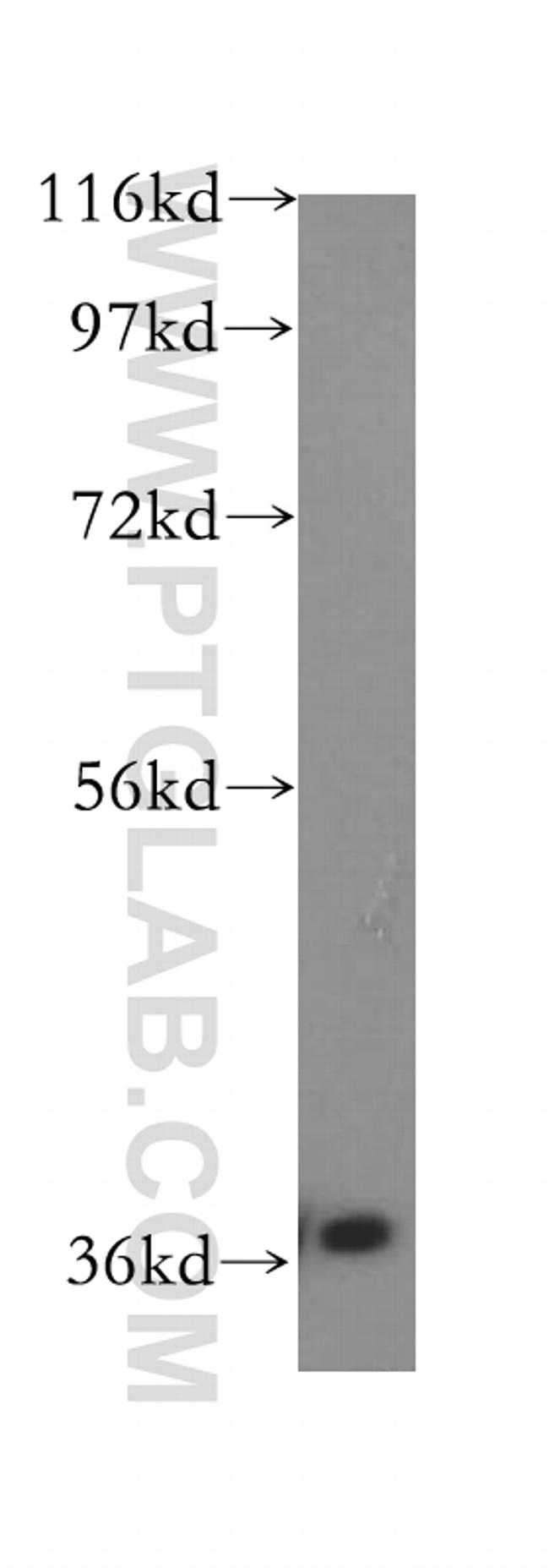 IkB alpha Antibody in Western Blot (WB)
