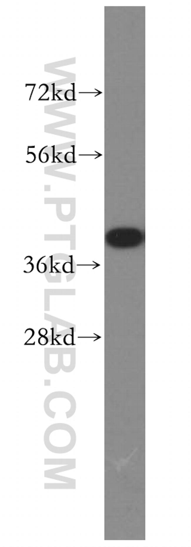 IkB alpha Antibody in Western Blot (WB)