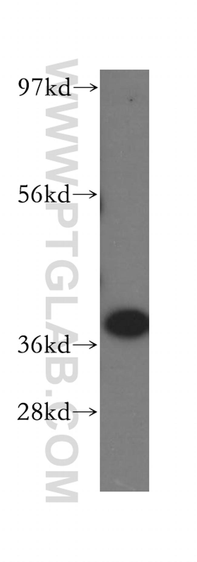 IkB alpha Antibody in Western Blot (WB)