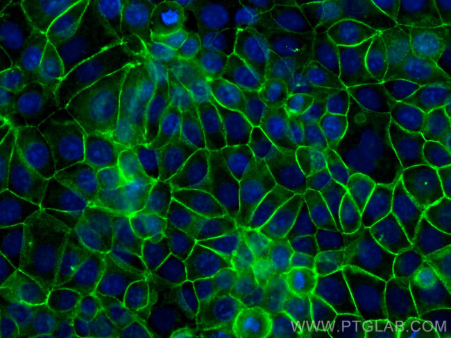 beta-Catenin Antibody in Immunocytochemistry (ICC/IF)