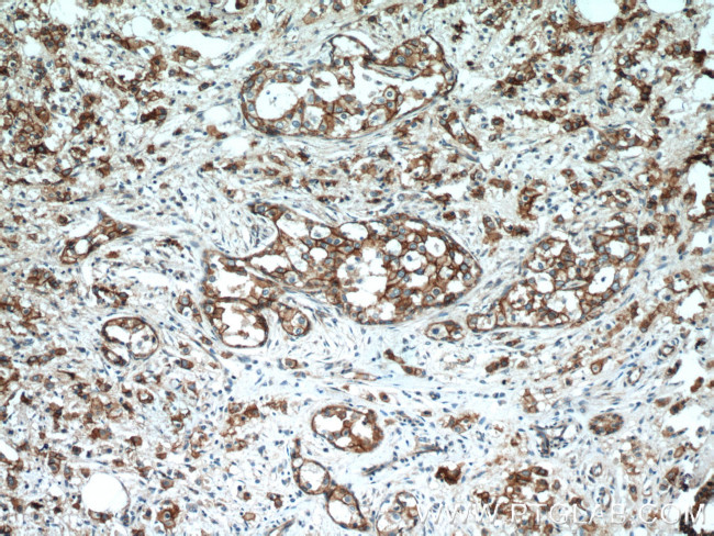 beta-Catenin Antibody in Immunohistochemistry (Paraffin) (IHC (P))