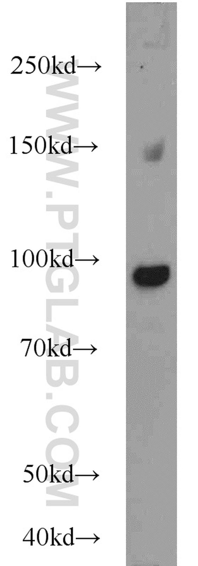 beta-Catenin Antibody in Western Blot (WB)