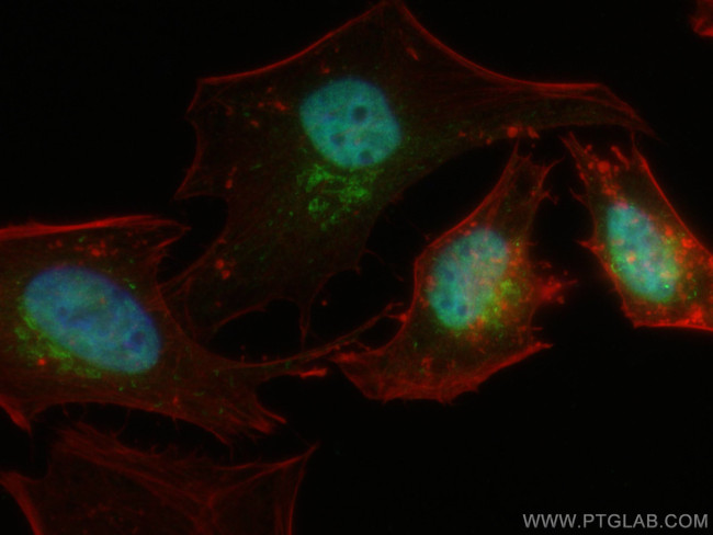 ERK1/2 Antibody in Immunocytochemistry (ICC/IF)