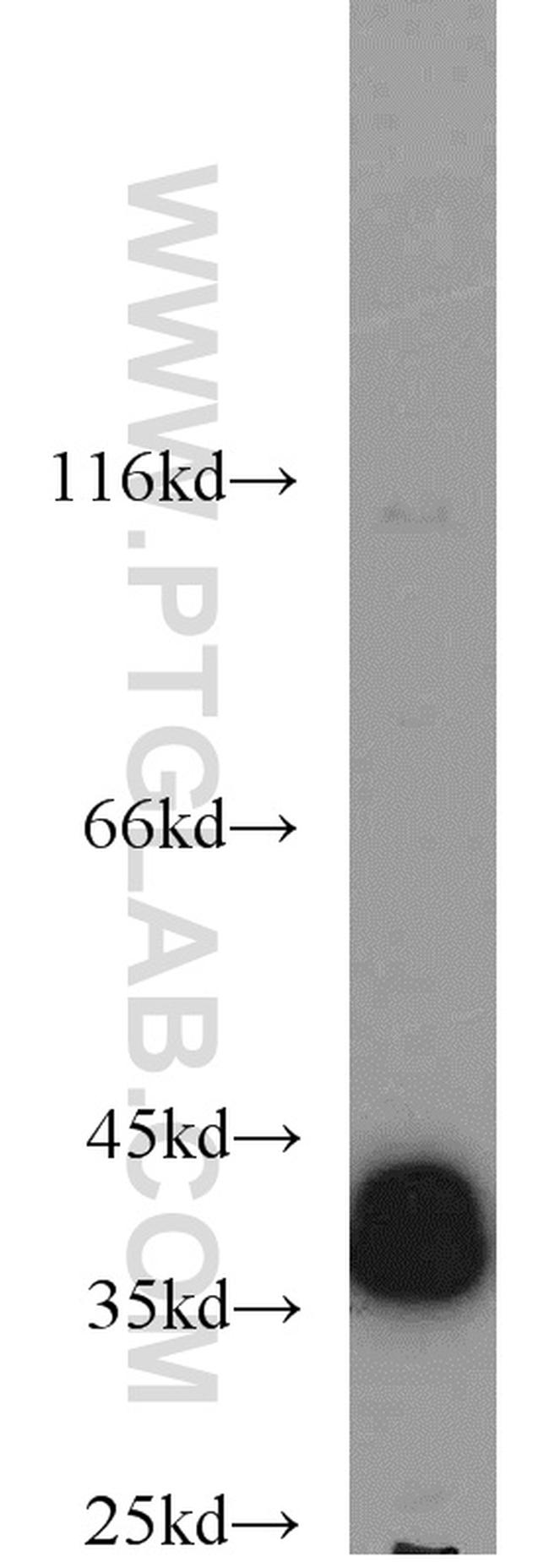 ERK1/2 Antibody in Western Blot (WB)