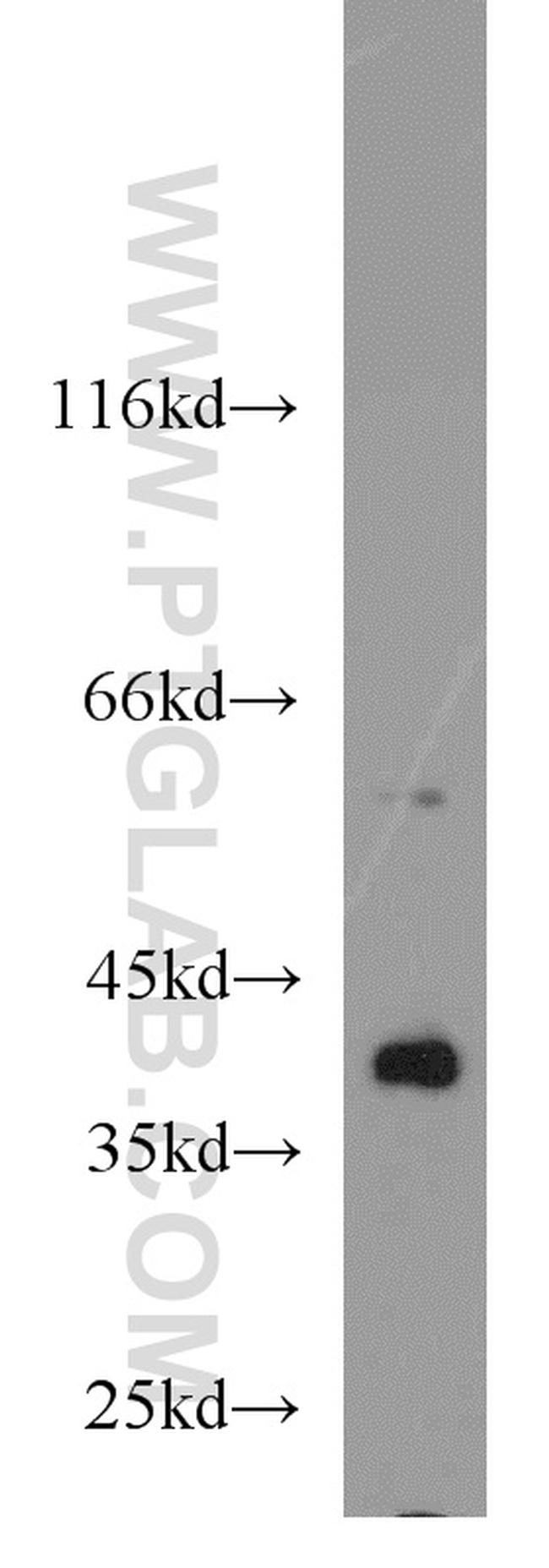 ERK1/2 Antibody in Western Blot (WB)