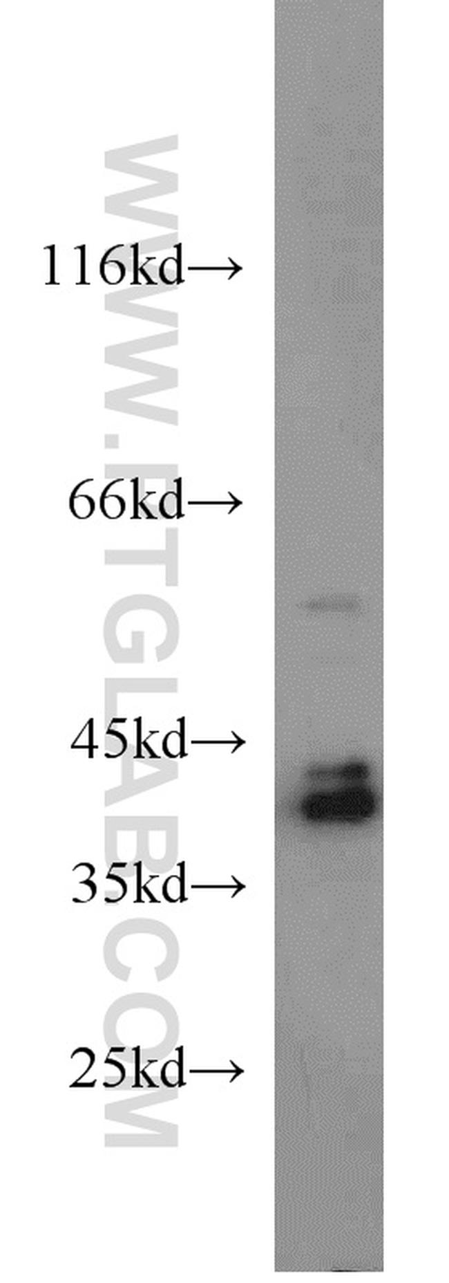 ERK1/2 Antibody in Western Blot (WB)