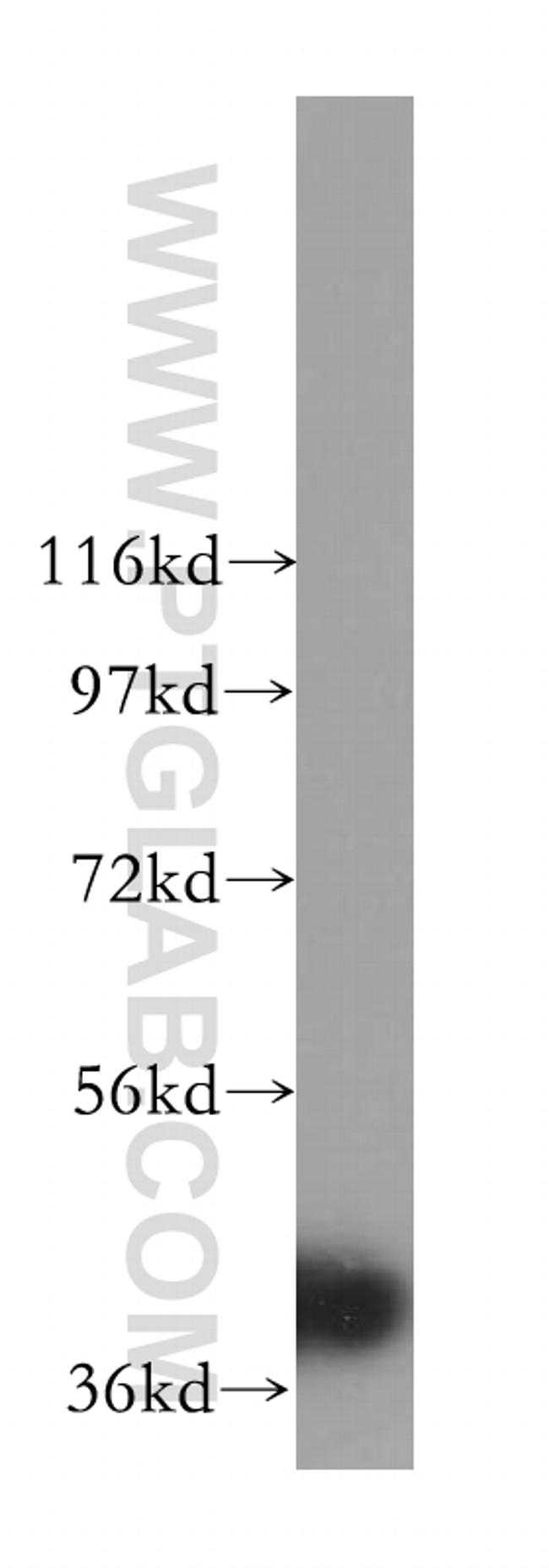 ERK1/2 Antibody in Western Blot (WB)