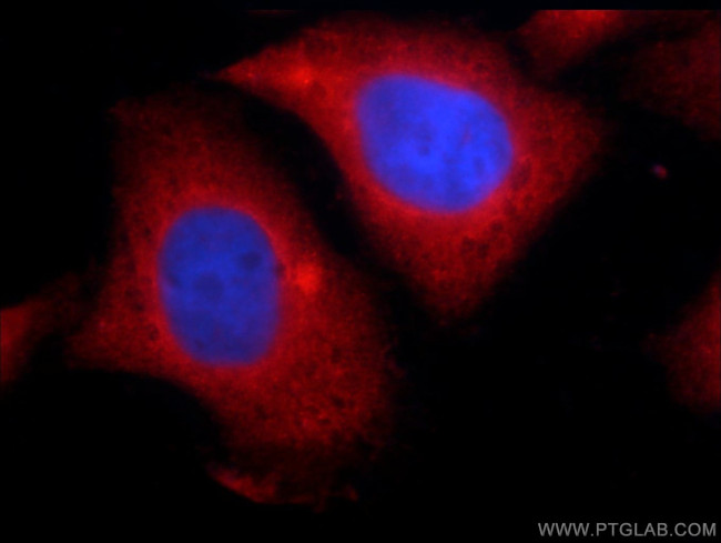 ERK1/2 Antibody in Immunocytochemistry (ICC/IF)