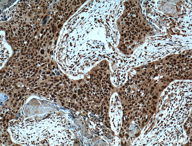 ERK1/2 Antibody in Immunohistochemistry (Paraffin) (IHC (P))