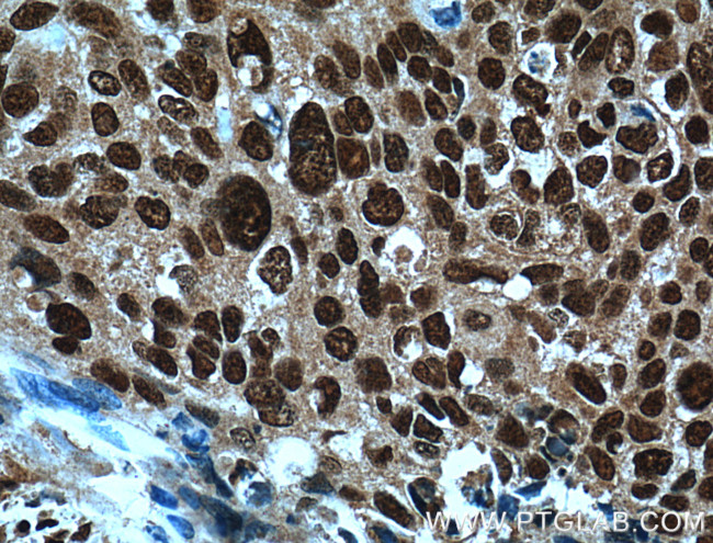 ERK1/2 Antibody in Immunohistochemistry (Paraffin) (IHC (P))