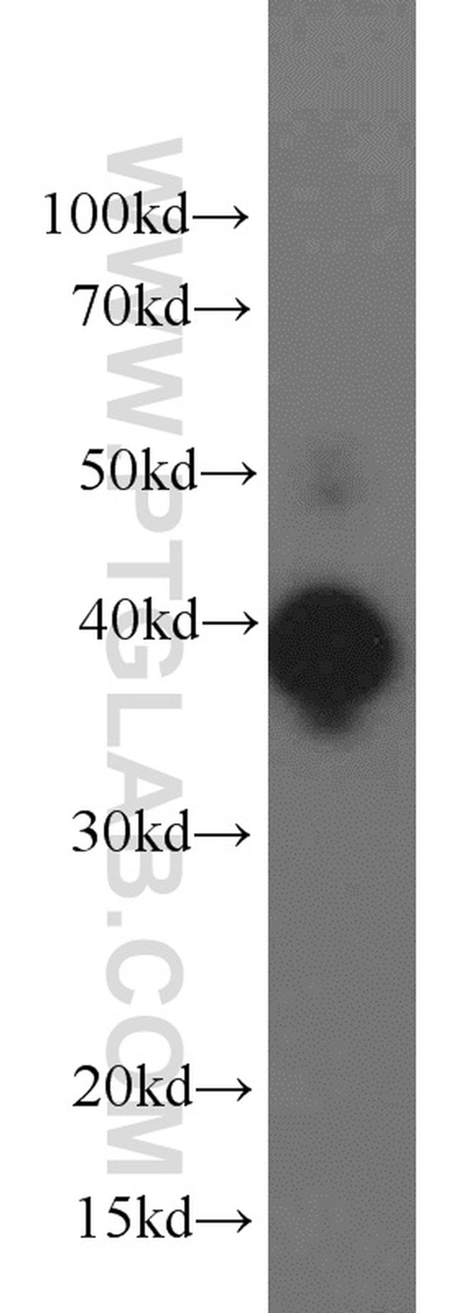 ERK1/2 Antibody in Western Blot (WB)