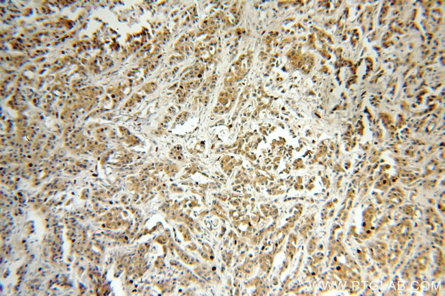 SMAD4 Antibody in Immunohistochemistry (Paraffin) (IHC (P))