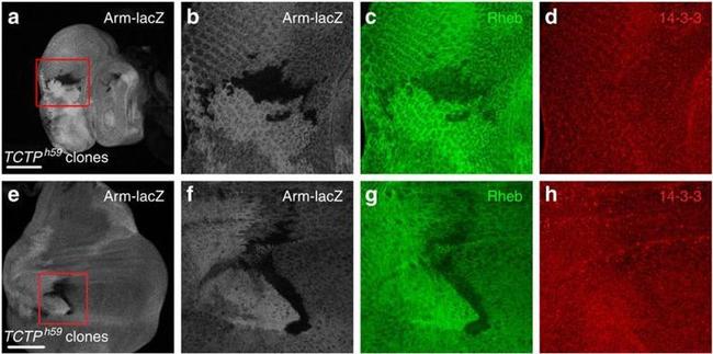 14-3-3 Pan Antibody in Immunohistochemistry (IHC)