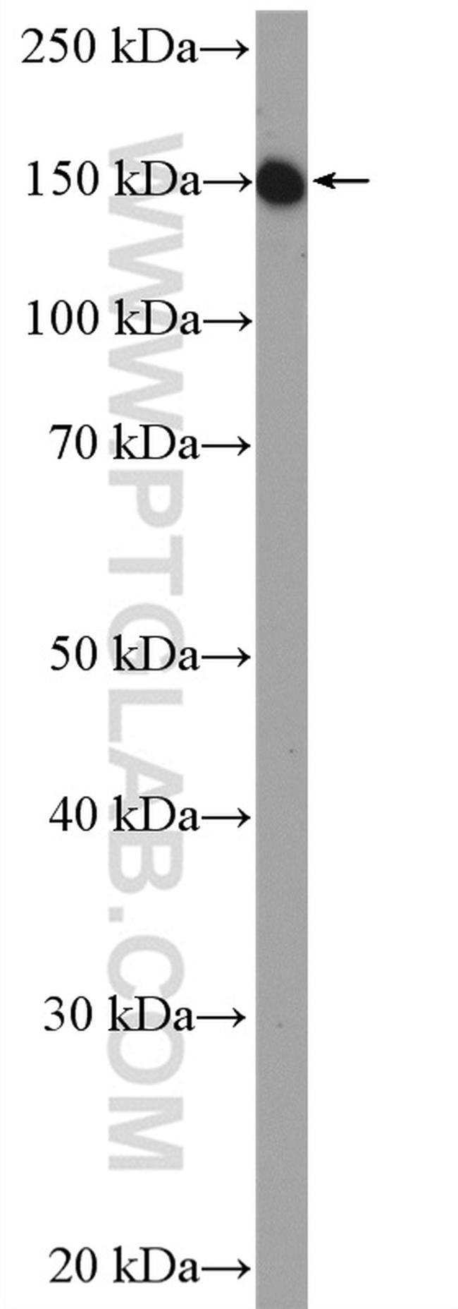 EGFR (C-terminal) Antibody in Western Blot (WB)