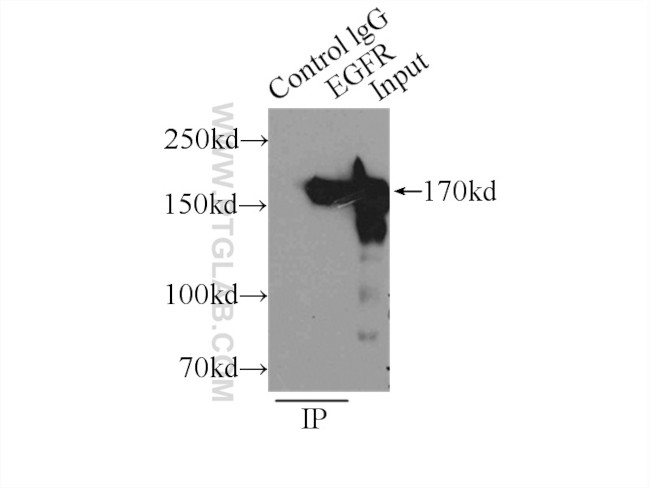 EGFR (C-terminal) Antibody in Immunoprecipitation (IP)