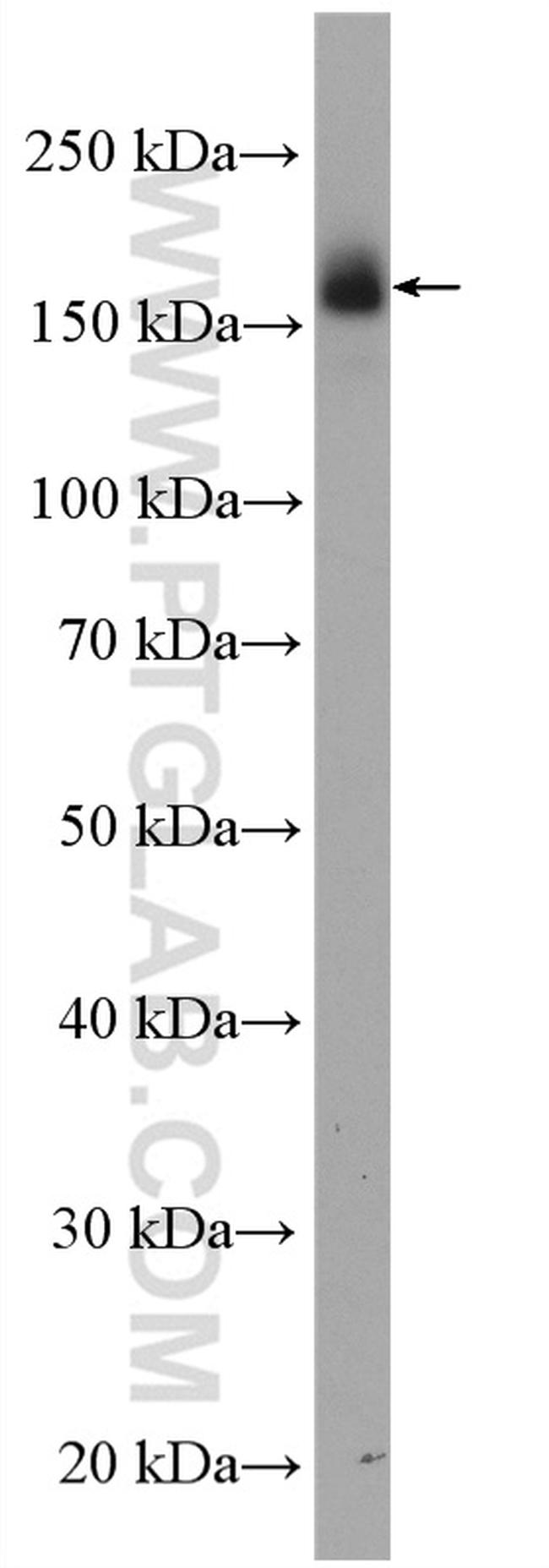 EGFR (C-terminal) Antibody in Western Blot (WB)