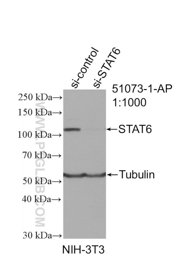 STAT6 Antibody in Western Blot (WB)