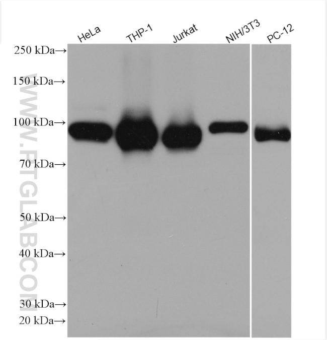 STAT6 Antibody in Western Blot (WB)