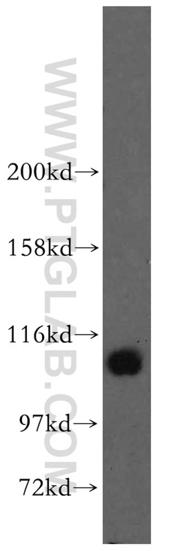 STAT6 Antibody in Western Blot (WB)