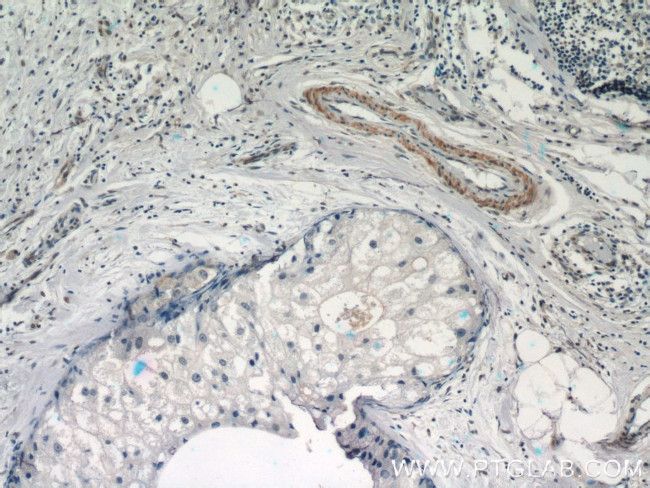 STAT5A Antibody in Immunohistochemistry (Paraffin) (IHC (P))