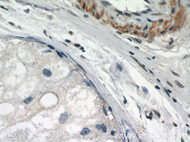 STAT5A Antibody in Immunohistochemistry (Paraffin) (IHC (P))