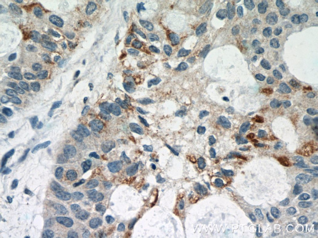 STAT5A Antibody in Immunohistochemistry (Paraffin) (IHC (P))