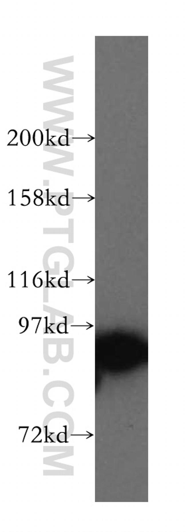 STAT5A Antibody in Western Blot (WB)