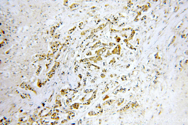 STAT2 Antibody in Immunohistochemistry (Paraffin) (IHC (P))