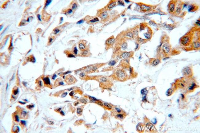 STAT2 Antibody in Immunohistochemistry (Paraffin) (IHC (P))