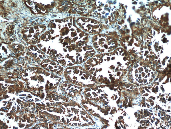 STAT2 Antibody in Immunohistochemistry (Paraffin) (IHC (P))