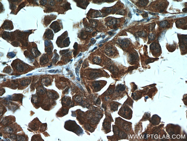 STAT2 Antibody in Immunohistochemistry (Paraffin) (IHC (P))