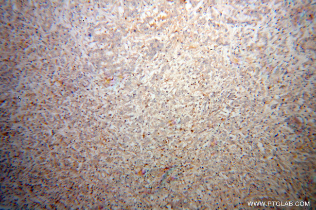 STAT2 Antibody in Immunohistochemistry (Paraffin) (IHC (P))