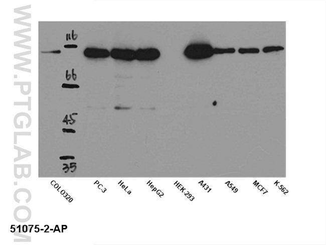 STAT2 Antibody in Western Blot (WB)