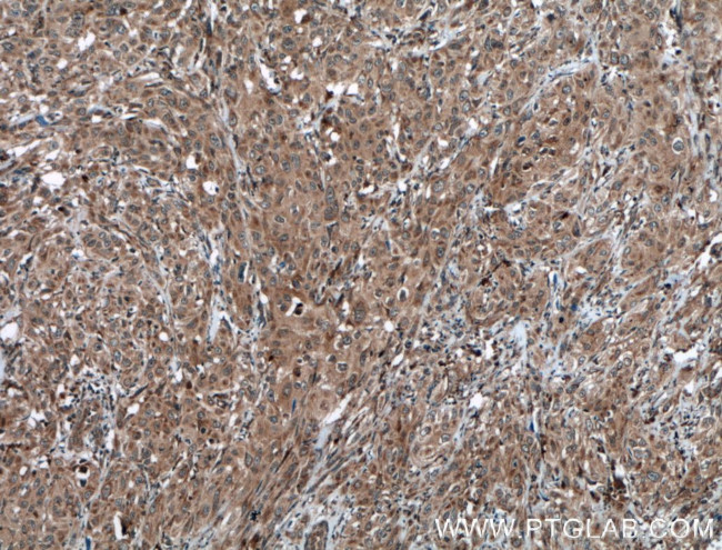 STAT3 Antibody in Immunohistochemistry (Paraffin) (IHC (P))