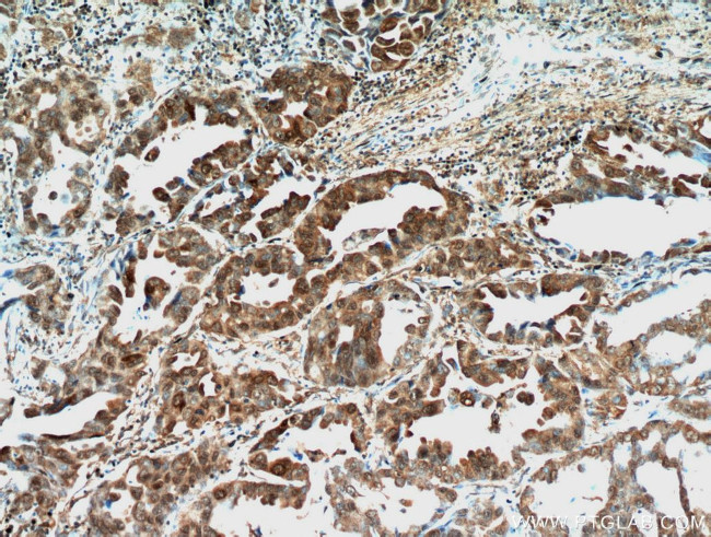 STAT3 Antibody in Immunohistochemistry (Paraffin) (IHC (P))