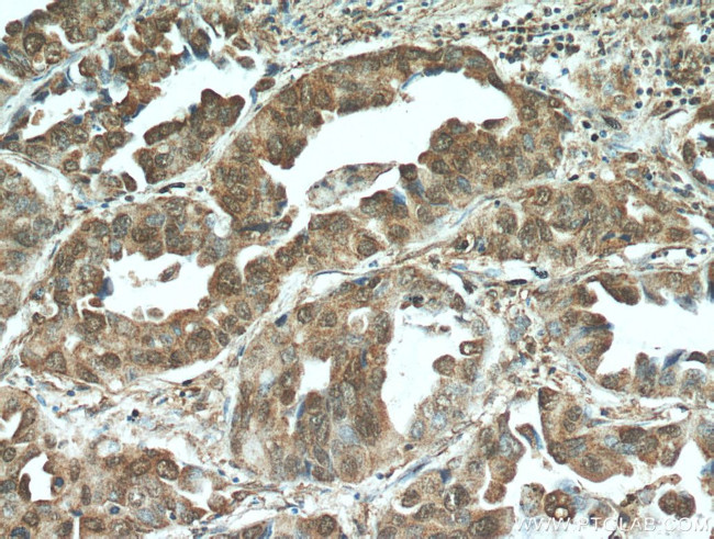 STAT3 Antibody in Immunohistochemistry (Paraffin) (IHC (P))