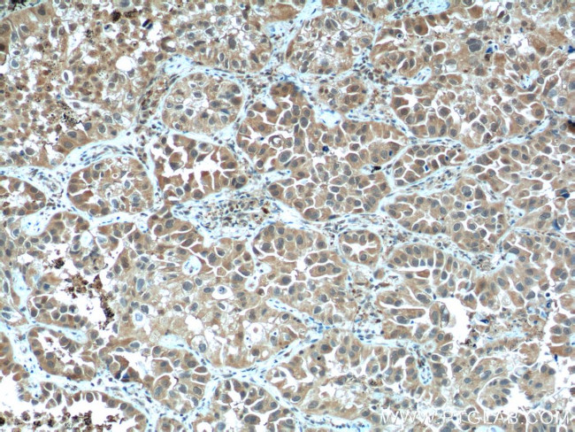 STAT3 Antibody in Immunohistochemistry (Paraffin) (IHC (P))