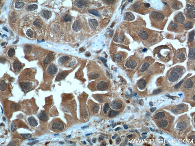 STAT3 Antibody in Immunohistochemistry (Paraffin) (IHC (P))