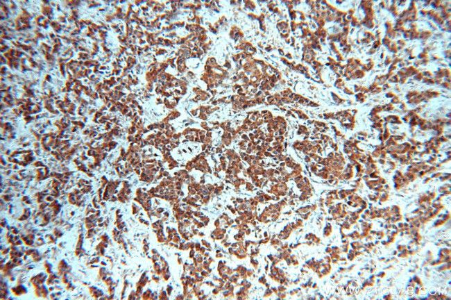 STAT3 Antibody in Immunohistochemistry (Paraffin) (IHC (P))