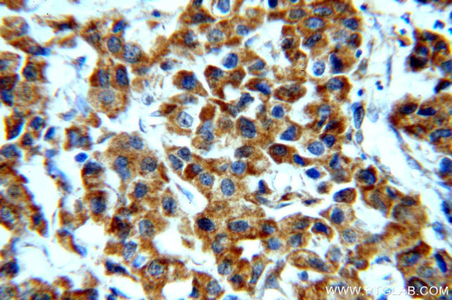 STAT3 Antibody in Immunohistochemistry (Paraffin) (IHC (P))