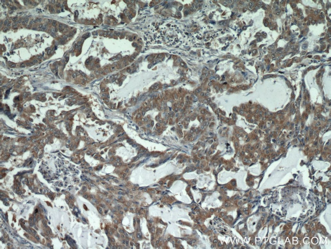 STAT3 Antibody in Immunohistochemistry (Paraffin) (IHC (P))