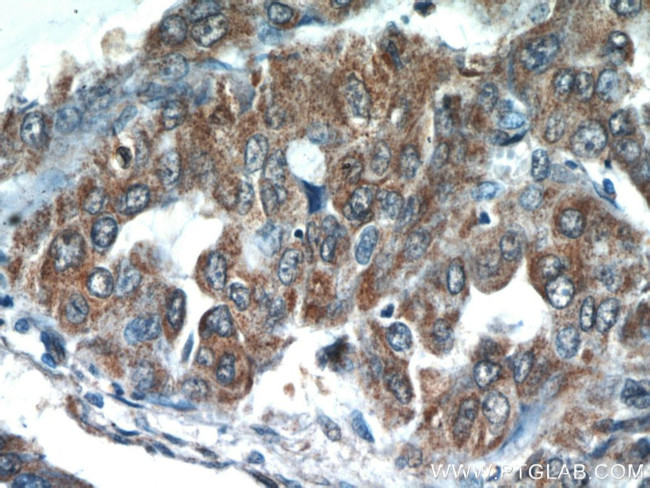 STAT3 Antibody in Immunohistochemistry (Paraffin) (IHC (P))