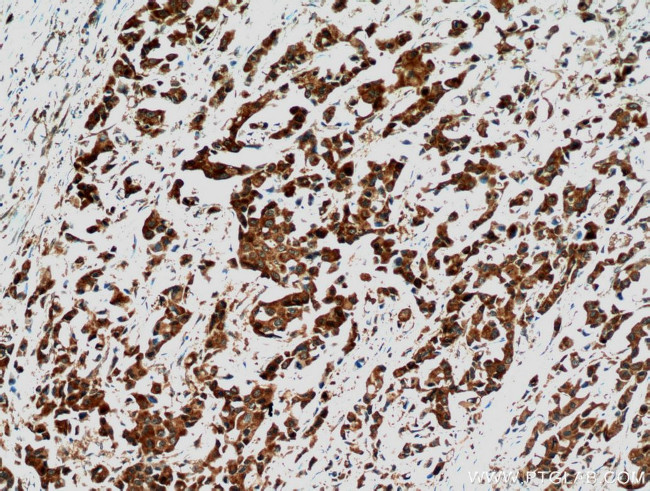 STAT3 Antibody in Immunohistochemistry (Paraffin) (IHC (P))