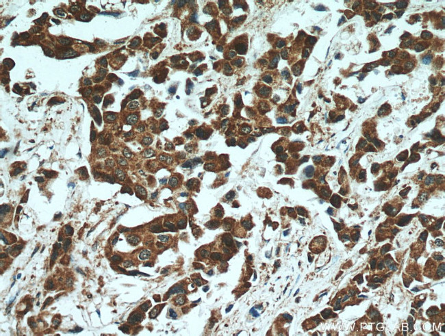 STAT3 Antibody in Immunohistochemistry (Paraffin) (IHC (P))