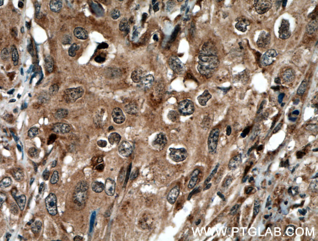 STAT3 Antibody in Immunohistochemistry (Paraffin) (IHC (P))