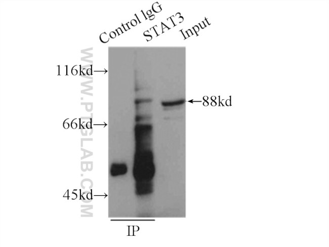 STAT3 Antibody in Immunoprecipitation (IP)