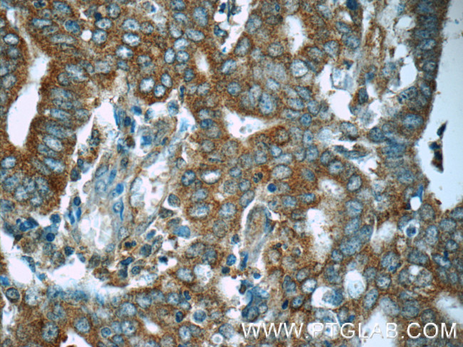 MEK1 Antibody in Immunohistochemistry (Paraffin) (IHC (P))