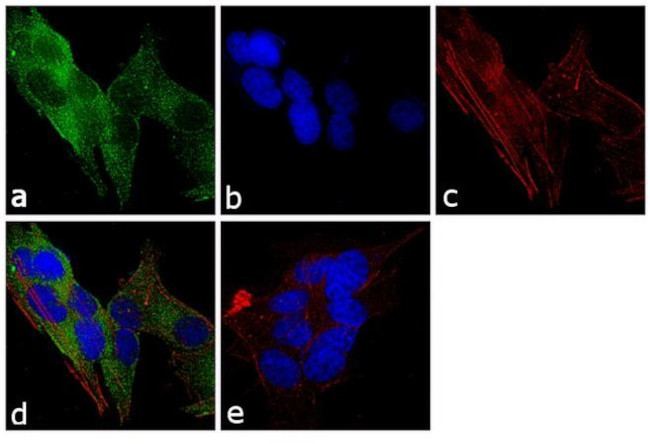 RhoGDI Antibody in Immunocytochemistry (ICC/IF)