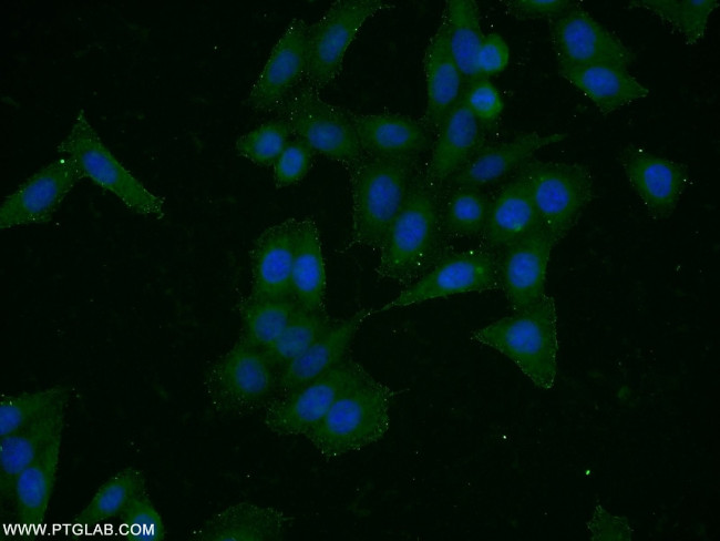 HER2/ErbB2 Antibody in Immunocytochemistry (ICC/IF)